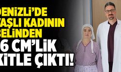 Denizli’de Yaşlı Kadının Belinden 16 Cm’lik Kitle Çıktı!