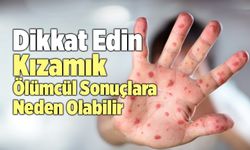 Kızamık Nedir? Kızamık Ölümcül Sonuçlara Neden Olabilir