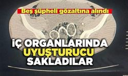 İç Organlarında Uyuşturucu Sakladılar