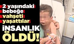 İnsanlık öldü 2 yaşındaki bebeğe eziyet ettiler