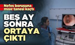 Nefes borusuna kaçan mısır tanesi 5 ay sonra ortaya çıktı