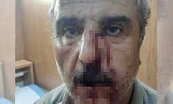 Emekli öğretmen o saldırıyı anlattı