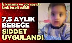 7,5 Aylık bebeğe şiddet uygulandı