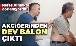 Nefes almakta zorlanıyordu, akciğerinden dev balon çıktı
