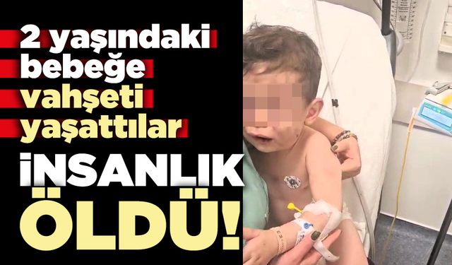İnsanlık öldü 2 yaşındaki bebeğe eziyet ettiler