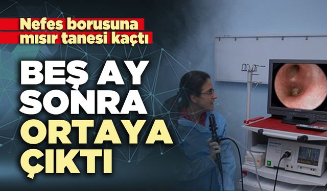 Nefes borusuna kaçan mısır tanesi 5 ay sonra ortaya çıktı