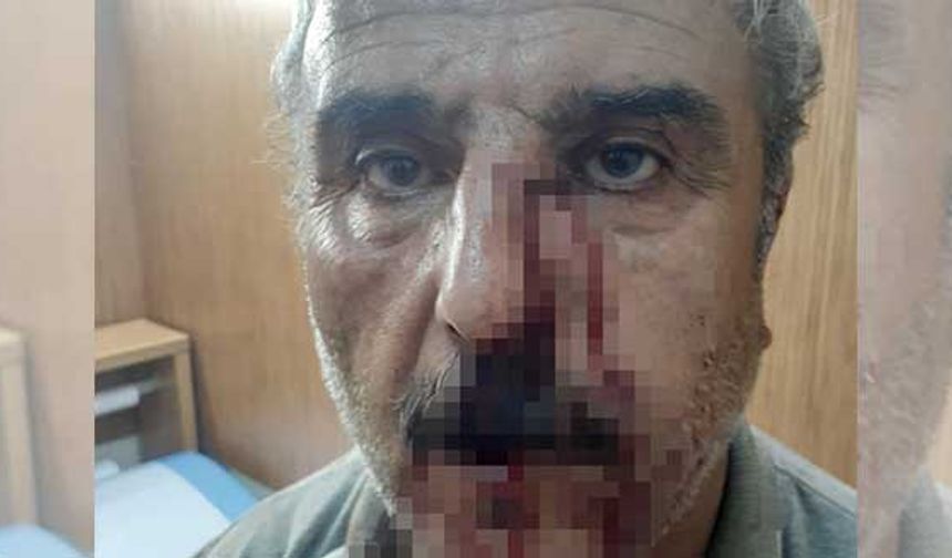 Emekli öğretmen o saldırıyı anlattı