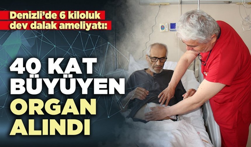 Denizli’de 6 kiloluk dev dalak ameliyatı: 40 kat büyüyen organ alındı
